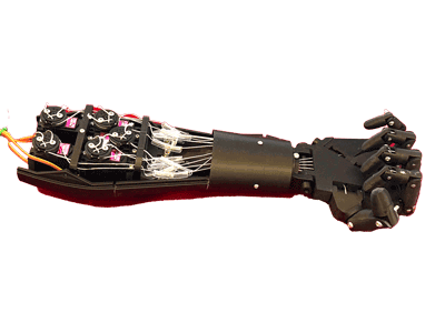 Machine Learning Enhanced EMG Prosthetic Arm
